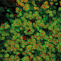 Nervenzellen (grün), in deren Zellkern die Fumarsäure (rot) gewandert ist (Foto: RUB)