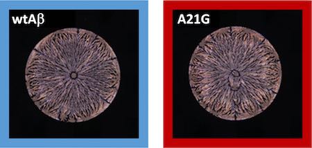 Neuronale Netzwerke erkennen kleinste Unterschiede in den Trocknungsmustern von Peptid-Lösungen (links: Amyloid-beta-(Aβ42)-Peptid, rechts: Mutation), Foto: KIT Neuronale Netzwerke erkennen kleinste Unterschiede in den Trocknungsmustern von Peptid-Lösungen (links: Amyloid-beta-(Aβ42)-Peptid, rechts: Mutation), Foto: KIT