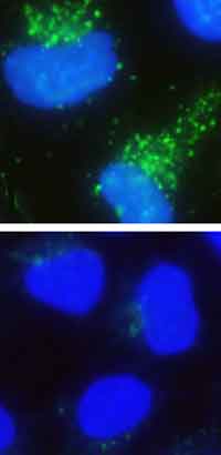 Zellen, die von SNX18 umgeben sind - links - und Zellen mit weniger Abbauproteinen (Photo: Umeå University)